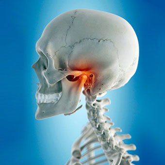 Jaw Joint Disorder